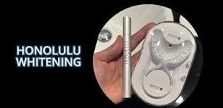歯を白くしたい、でもまだ迷っている方へ。 〜MASHIROのホワイトニングが選ばれる理由と、忙しい方への新提案〜