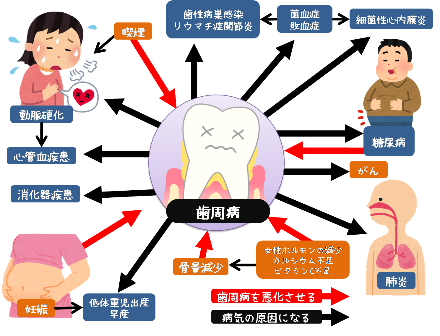 歯石って取らないといけないの？