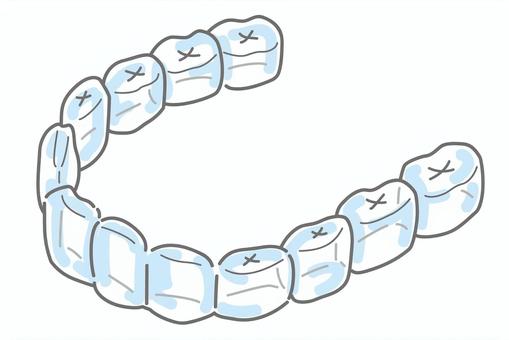 音がしない歯ぎしりに要注意