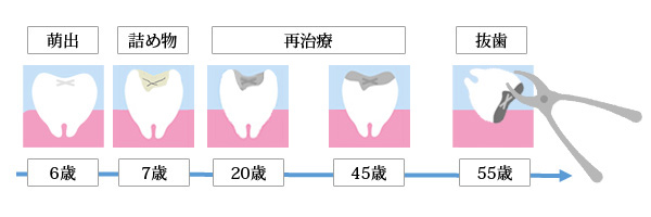 80歳までの治療費推計 ¥4,354,000