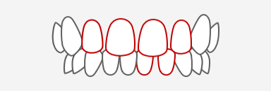 すきっ歯 (歯と歯の間にすきまがある)